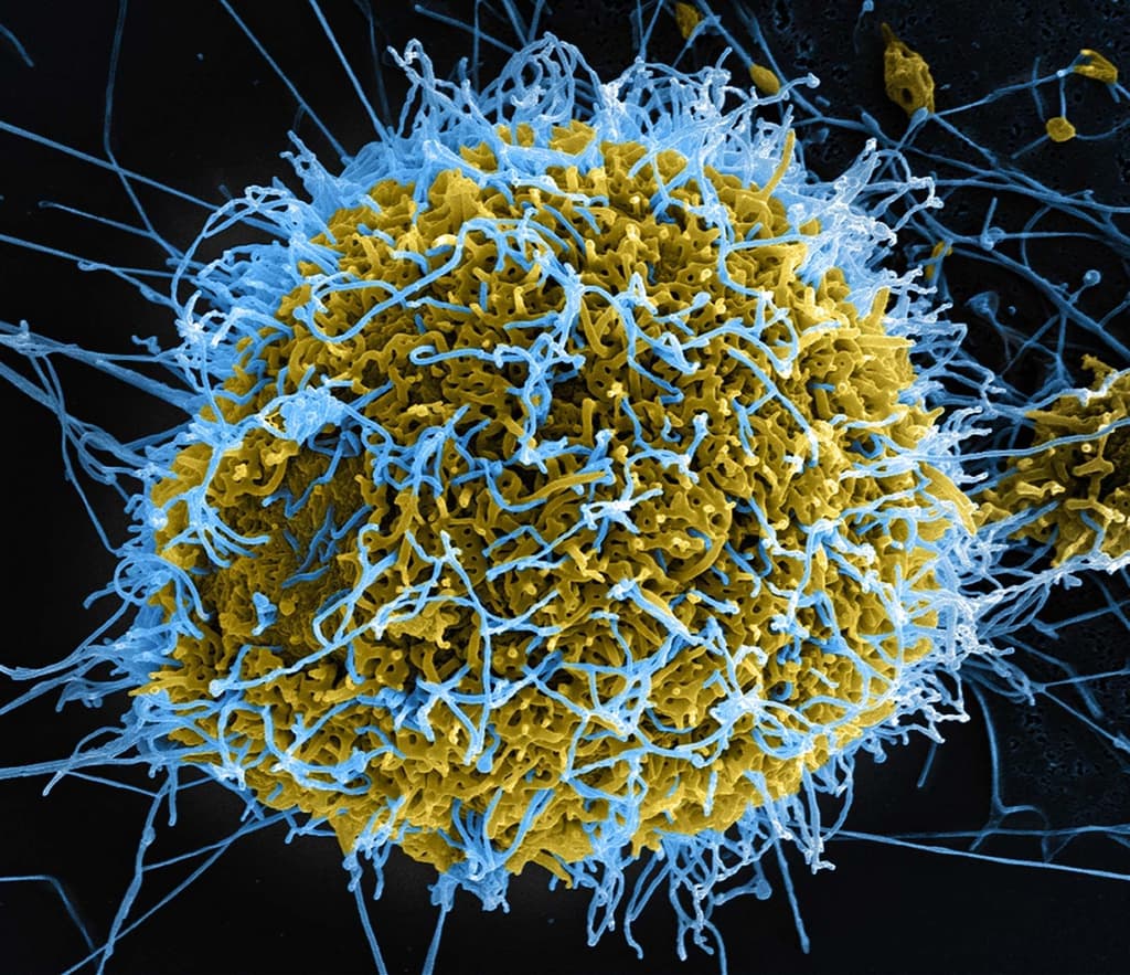 icon for Ebola pandemic in 2026?